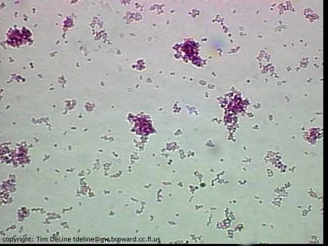 Staphylococcus aureus, bacterium